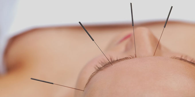 You are currently viewing Tips for DIY Acupuncture